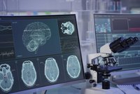Modern neuroscience laboratory with a microscope in front of two monitors. The screens show brain scans, a digital 3D representation of a brain, as well as various analysis charts and measurement data.