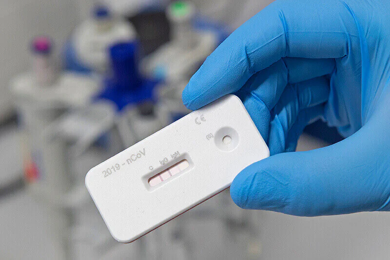 Senova entwickelt Corona-Schnelltest, Bild: Infectognostics / Jens Meyer 